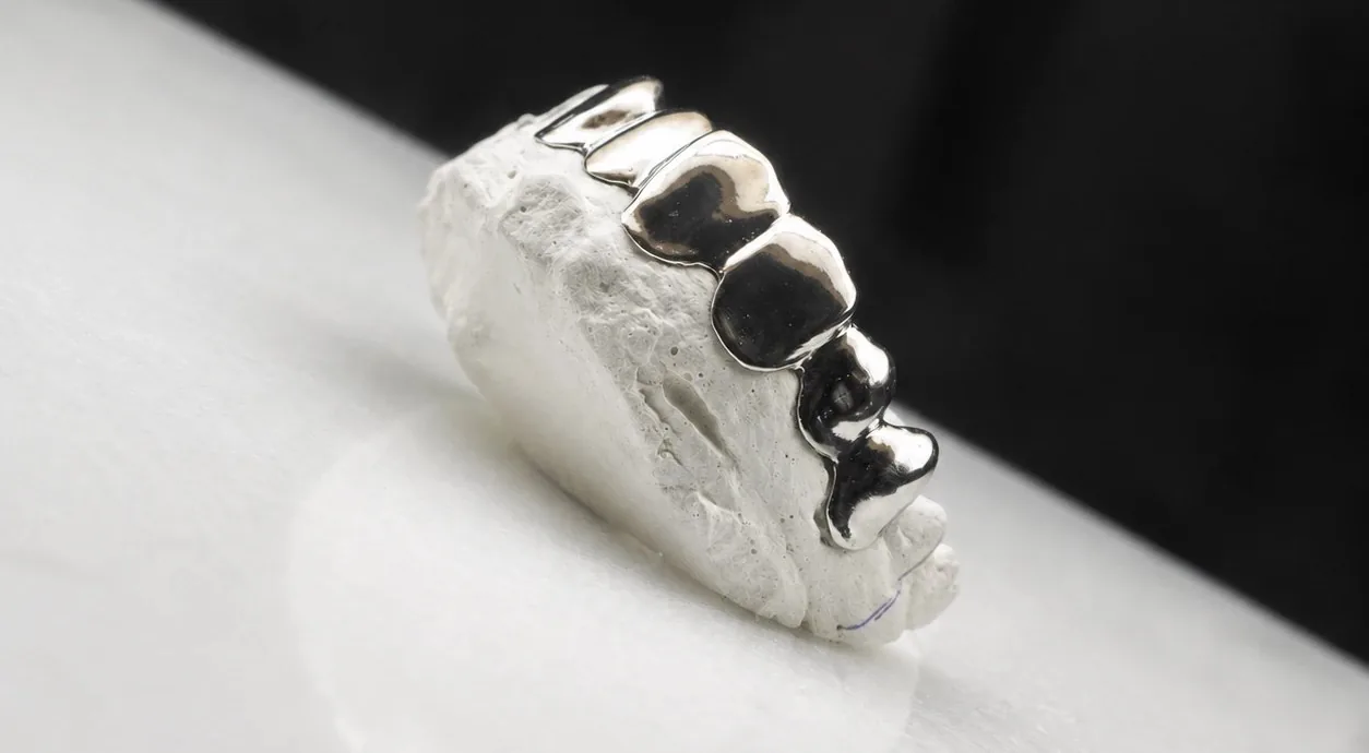 GrillZ sobre un modelo dental
